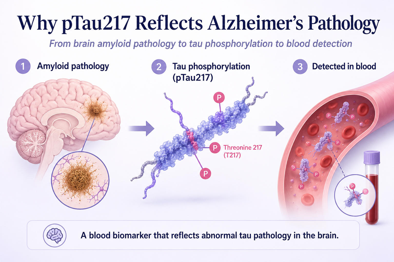 Why pTau217 Can Reveal Alzheimer’s Pathology from Blood