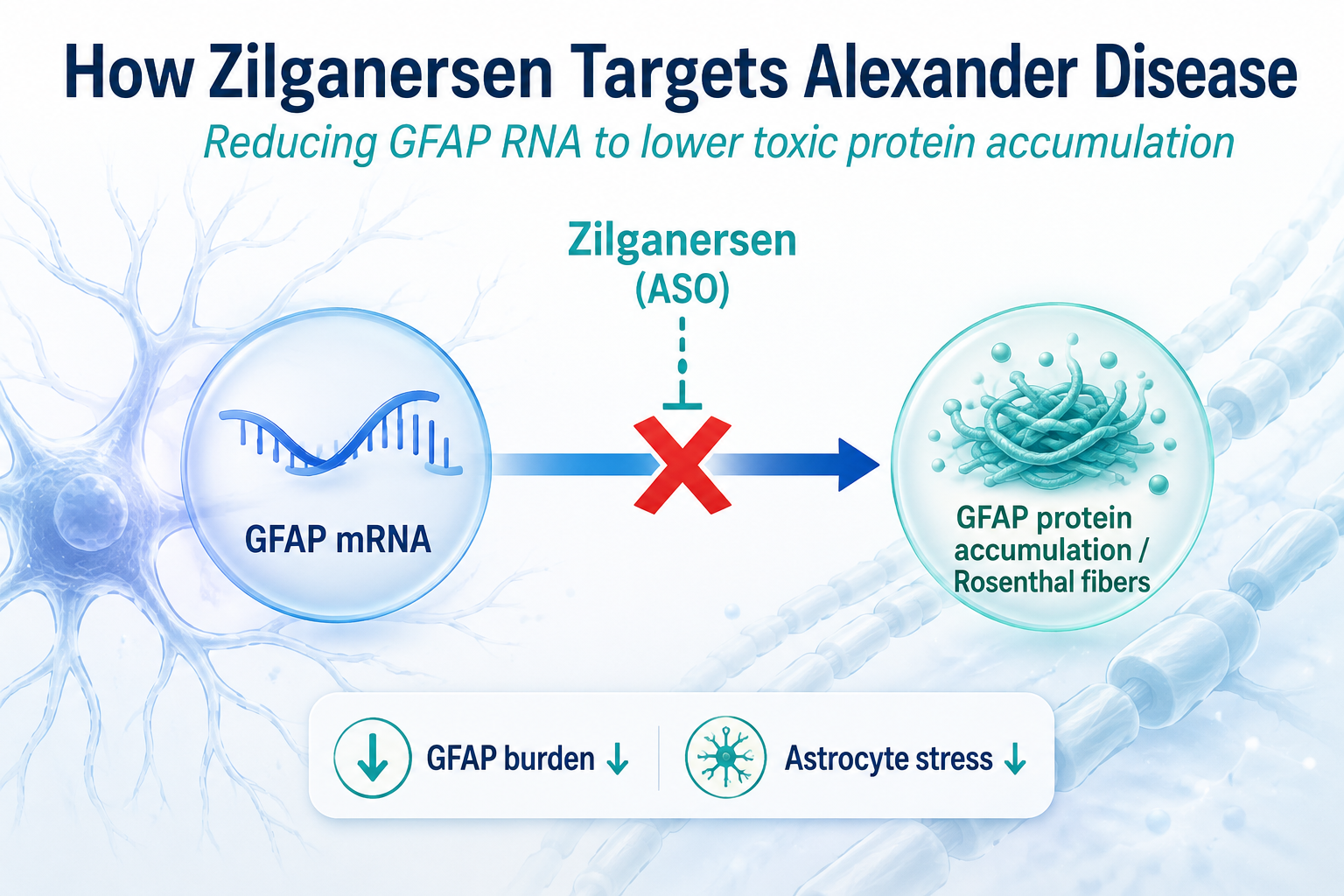 How Zilganersen Targets Alexander Disease by Reducing GFAP RNA